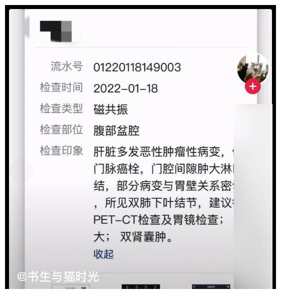 知名网红因肝癌晚期去世，将无偿捐献遗体，上个月还在众筹医药费